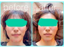 トーラス 整体(TORUS)/左右差改善