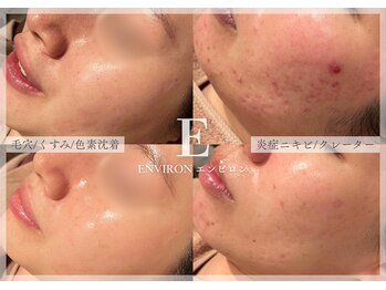 シューラディアント(ShuRadiant)