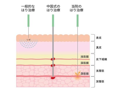 あんにょん鍼灸院の写真