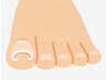 【巻き爪矯正】1本￥3300