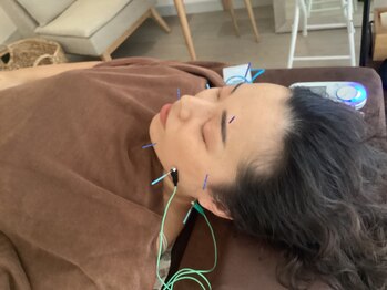 ハリファ鍼灸院 横浜関内院(HariFa鍼灸院)/美容施術