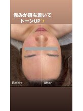 ラリリー(La Lily)/エアーの力すごい！