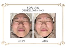 エコム(ECOM)/いくつになっても素肌はキレイに