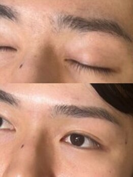 メンズネオ 長崎店(men's NEO)の写真/《men's NEOだからこそできる圧倒的な技術!》アイブロウ・フェイシャルwax・脱毛でモテ顔×清潔感劇的UP★