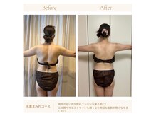 痩せても、皮膚がたるむ心配はありません！