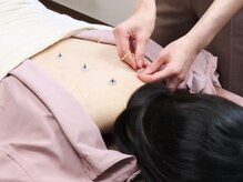 コハル鍼灸整骨院 本郷三丁目(COHARU鍼灸整骨院)