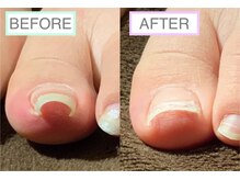 巻き爪研究所 鶴見院