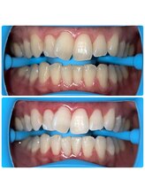 コナホワイトニング 神保町/御茶ノ水ホワイトニング