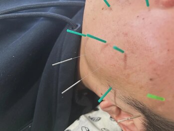 整体院ふくまるの写真/【国家資格者の鍼灸×整体】お顔の歪み・顎の違和感を徹底ケア◆フェイスラインすっきり小顔へ！