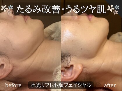 ミトラ(MITRA)の写真