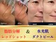 アンシャンテ(Anchant)の写真