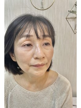 シアミス(SIAMIHS)/トリートメント