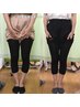 【2回目以降ご来院の方限定】O脚矯正　￥4600