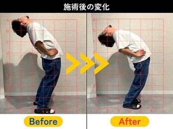 西巣鴨駅前整体院/☆施術ビフォーアフター☆