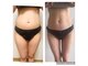 ヨサパーク ビューティスマイル(YOSAPARK BeautySmile)の写真