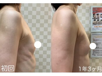 ハレオラ(HaleOla)/50代☆こつこつ1年3ヶ月の成果♪