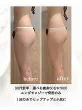 モア 恵比寿(MORE.)/1回で小尻・ヒップアップ