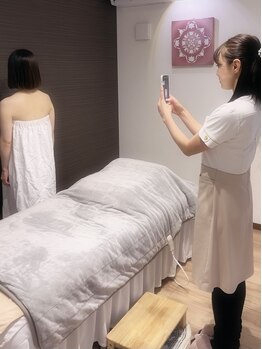 小顔になりたい