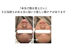 本気で肌を変えたい。そんな方をサポートします