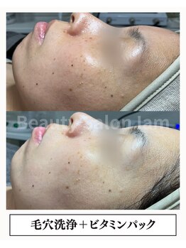 アイアム(Iam)の写真/【くすみ・透明感UP】毛穴汚れを取り除き、明るく、ツヤのある肌へ☆