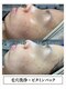 アイアム(Iam)の写真/【くすみ・透明感UP】毛穴汚れを取り除き、明るく、ツヤのある肌へ☆