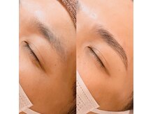 エムズハグ(M's hug)