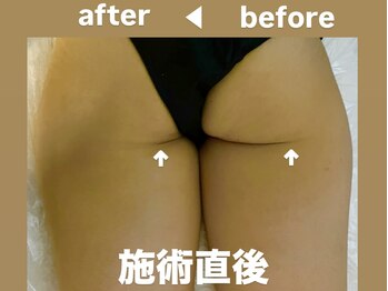 メゾン ド クロエ(Maison de Chloe)/Chloe式パーソナル痩身