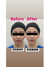 ゆうはり鍼灸整骨院 恵比寿/お客様Before　After