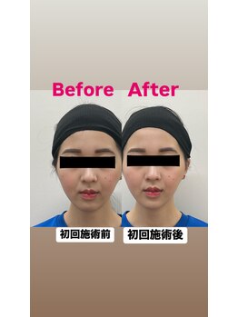 ゆうはり鍼灸整骨院 恵比寿/お客様Before　After