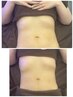 【お腹スッキリくびれに】お腹周りの贅肉撃退痩身コース40分¥8900→7000