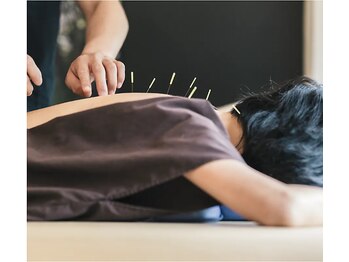 神谷澤鍼灸整骨院/鍼灸/はりきゅう