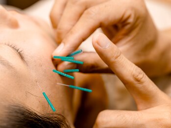 東浦和駅前整体院 鍼灸院/美容鍼