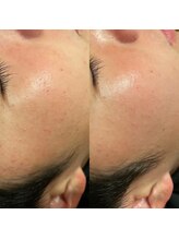 カンフリエ 吉野ヶ里店(Camphrier)/ダクトピール