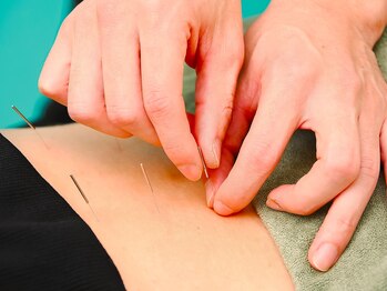 きりん接骨鍼灸院 尼崎武庫之荘店/腰の鍼施術（腰痛、妊活）