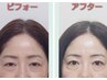 顔の印象がガラッと変わる★アイケア美顔器&ヘッドスパ&まつ毛パーマ120分