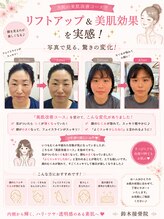美容整体スズキ(SUZUKI)/肌改善！！＆小顔