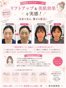 美容整体スズキ(SUZUKI)/肌改善！！＆小顔