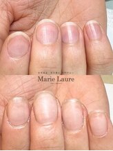 マリーロール 梅田店(Marie Laure)/自爪育成/深爪矯正/ネイルケア