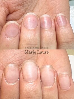 マリーロール 梅田店(Marie Laure)/自爪育成/深爪矯正/ネイルケア