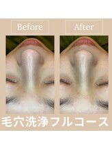 ルアナ 北谷店/毛穴洗浄毛穴ケア 《沖縄/北谷》