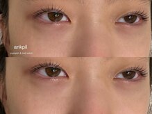 アノカプイル(ankpil)/【パリジェンヌラッシュリフト】