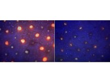 グラサヴォーグ 金沢店/夏の分泌過多＊黒角栓がすっきり