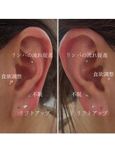 お肌想いラボ/耳ツボ症例写真