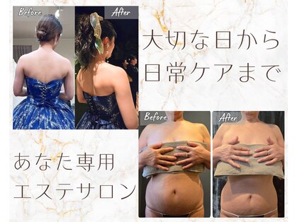 ベルココレ(Bellecocole)の写真