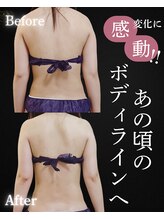 サンティエ(Santie)/背中・腕がスッキリ美しく♪