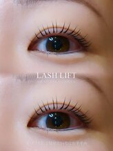 ジッピー オブ トータルビューティー アイエク(Zippy of totalbeauty iEQ)/