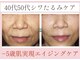 デュモンド(dumonde)の写真/４０代以降のお肌のたるみにお悩みの女性のための【極上フェイシャル】
ハリ・フェイスラインスッキリ！！