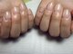 ケシュリー(Keshly)の写真/諦めていた爪の悩みも、自爪育成専門店にお任せ！健やかで美しい指先へ導きます♪
