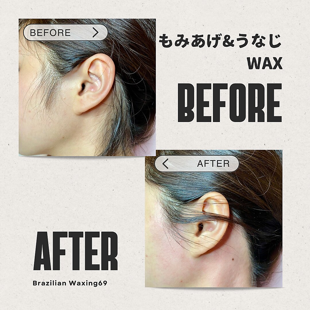 ブラジリアンワキシング シックスナイン(BrazilianWaxing69