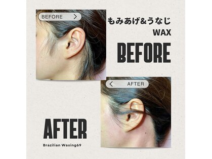 ブラジリアンワキシング シックスナイン(BrazilianWaxing69)の写真